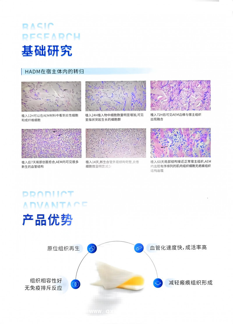 脫細(xì)胞異體真皮基質(zhì)軟組織補(bǔ)片