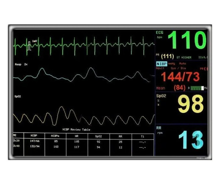 韓邁迪克醫(yī)療 心率變異分析系統(tǒng) SA-3000P 用于對(duì)心率進(jìn)行測(cè)量