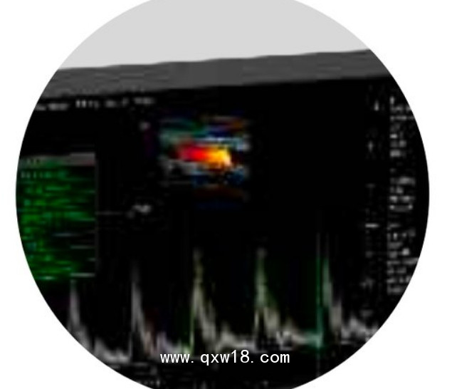 中旗 彩色多普勒超聲系統(tǒng) ViV 10