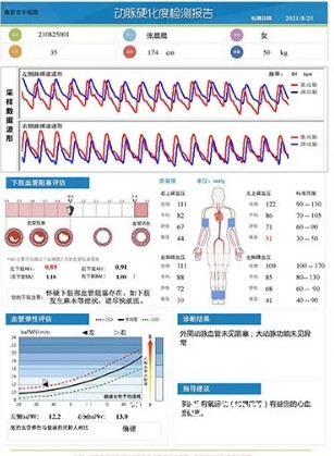 動(dòng)脈硬化檢測(cè)儀