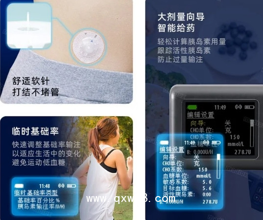 糖脈新款手機(jī)連接智能胰島素泵