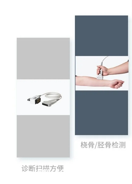 兒童 超聲骨密度檢測(cè)儀