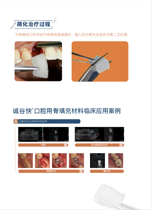口腔用骨填充材料