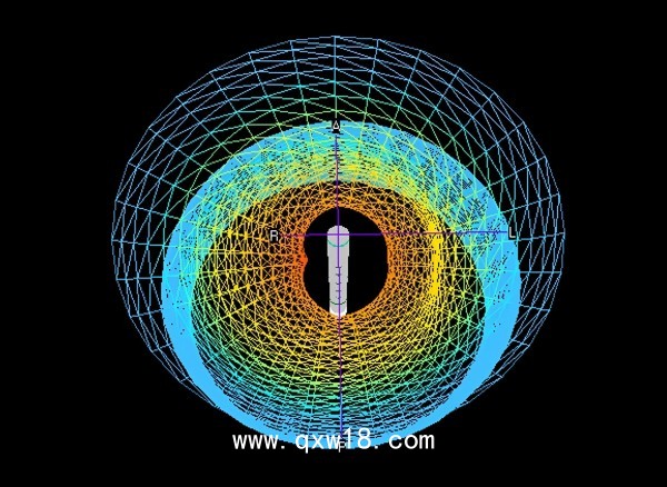 胃腸動力診斷系統(tǒng)