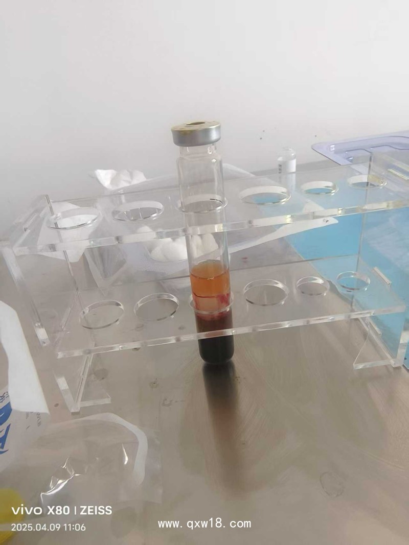 一次性使用富血小板血漿制備器 PRP濃縮液 配套PRP離心機(jī)獲取