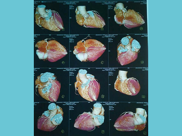 西施康牌醫(yī)用干式膠片--彩色噴墨、激光膠片