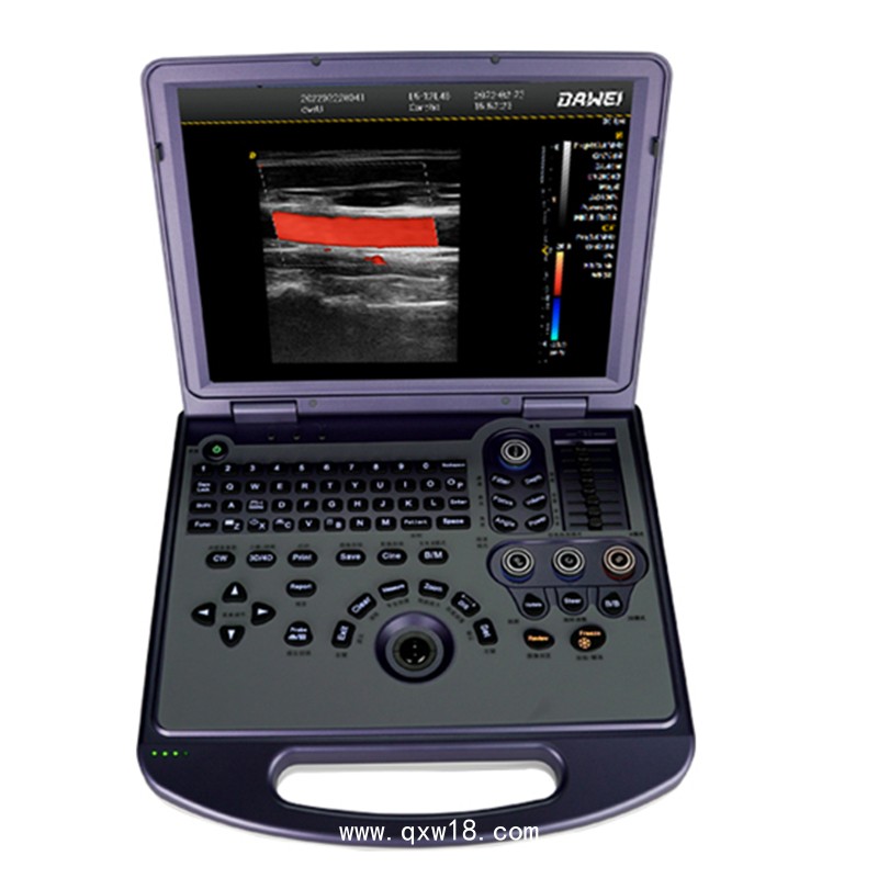 彩超機  便攜式彩超