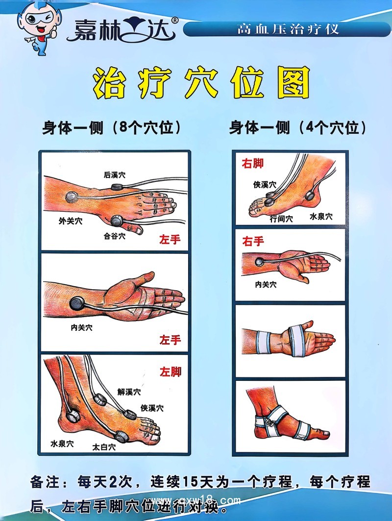 家庭診所社區(qū)型號高血壓治療儀 適用原發(fā)性高血壓病患者輔助治療JL-12II