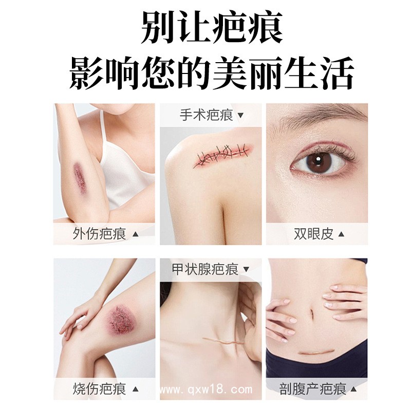 醫(yī)用疤痕貼代加工/可定制不同規(guī)格尺寸械字號(hào)/0元拿樣全流程質(zhì)檢