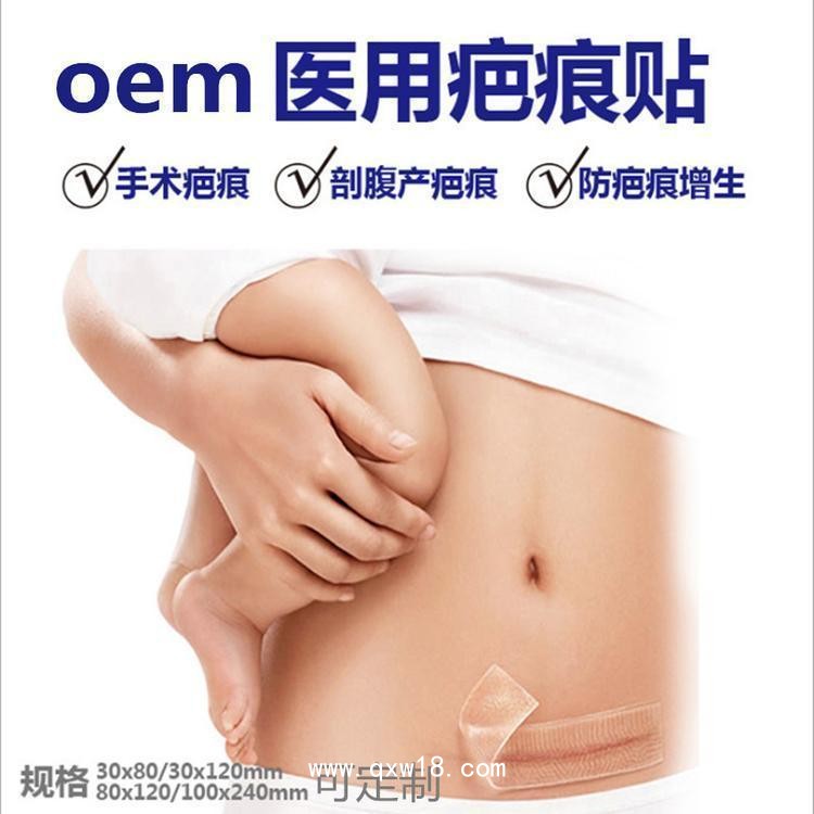 疤痕貼二類器械臨床掛網(wǎng)剖腹產(chǎn)疤痕新舊疤痕貼