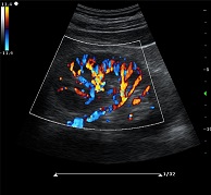 圖片關(guān)鍵詞