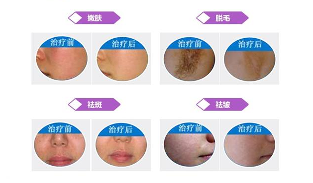 治療對(duì)比.jpg