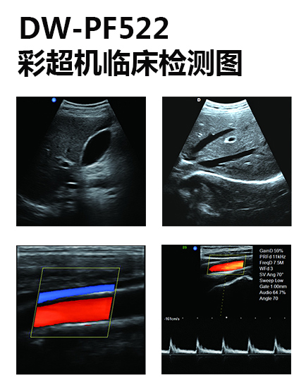 dw-PF522臨床檢測圖.jpg