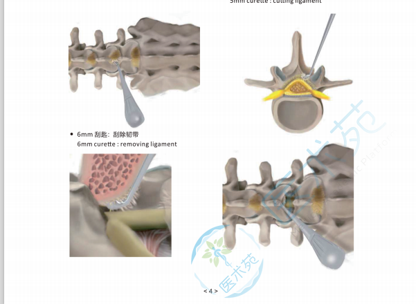 1608771416511175.png 1f61b67ba971b6c322478724a7a881d.png