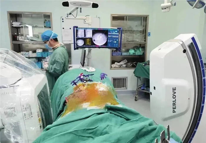 平板三維C形臂采集圖像 平板三維C形臂采集圖像