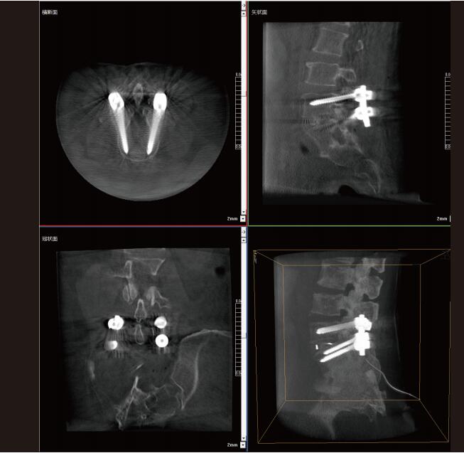 大功率平板三維C形臂影像