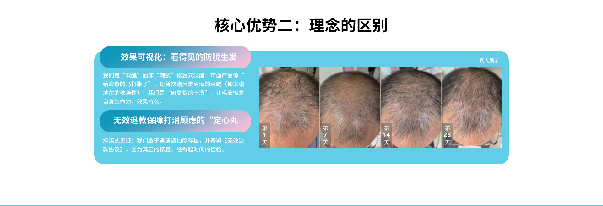 外泌體生發(fā)-涂抹劑型